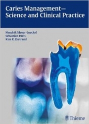 Caries Management - Science and Clinical Practice (pdf)